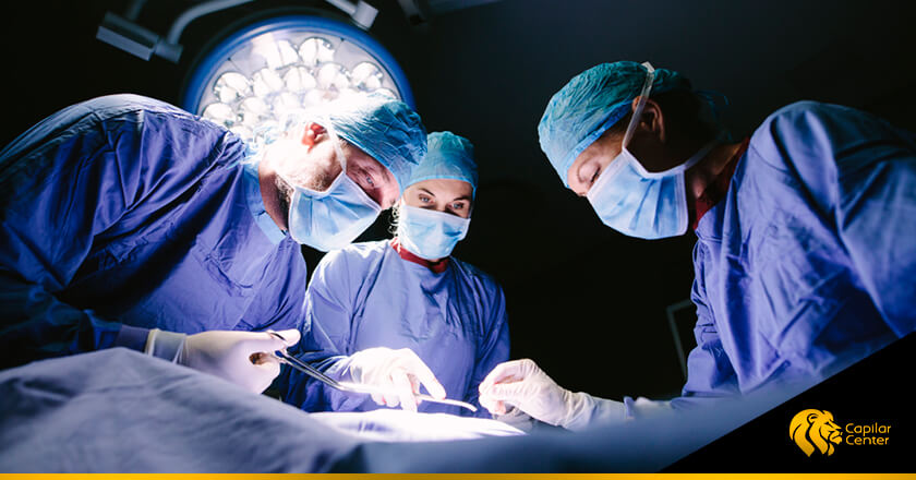 ¿Es mejor un Implante Capilar con un Cirujano Capilar o Técnico Capilar?