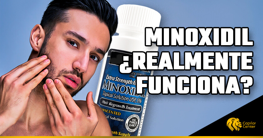 Minoxidil para la Barba: ¿realmente funciona?