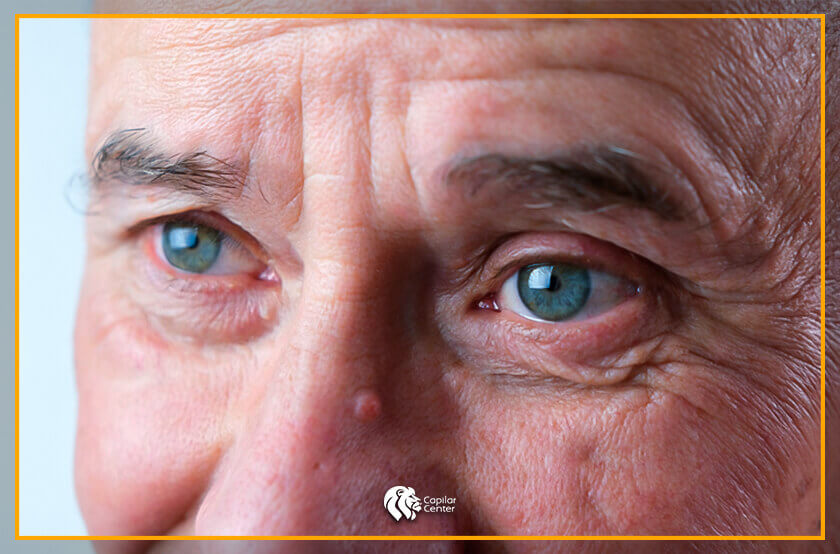 ¿Cuál es el factor que ocasiona unas cejas pobladas hombre en la longevidad?