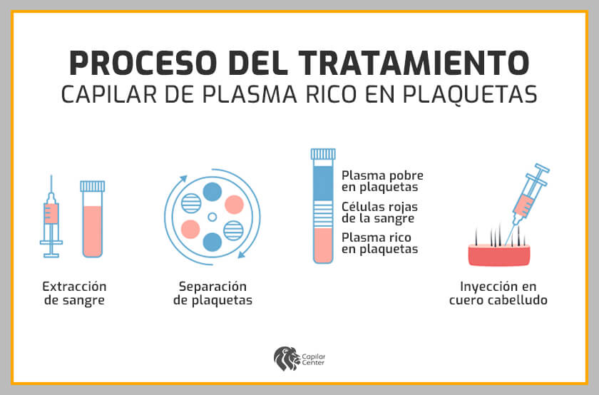 ¿Cómo funciona el plasma rico en plaquetas?