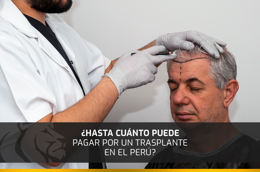 ¿Hasta cuánto puede pagar por un trasplante de cabello en el Perú?