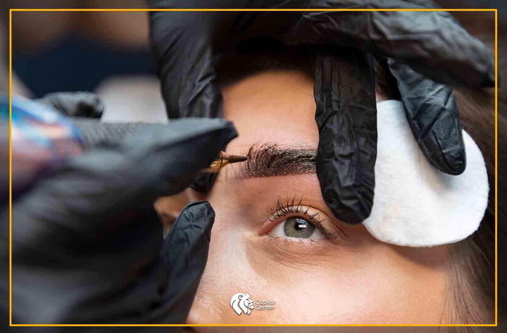 Implante o microblading - Resultados