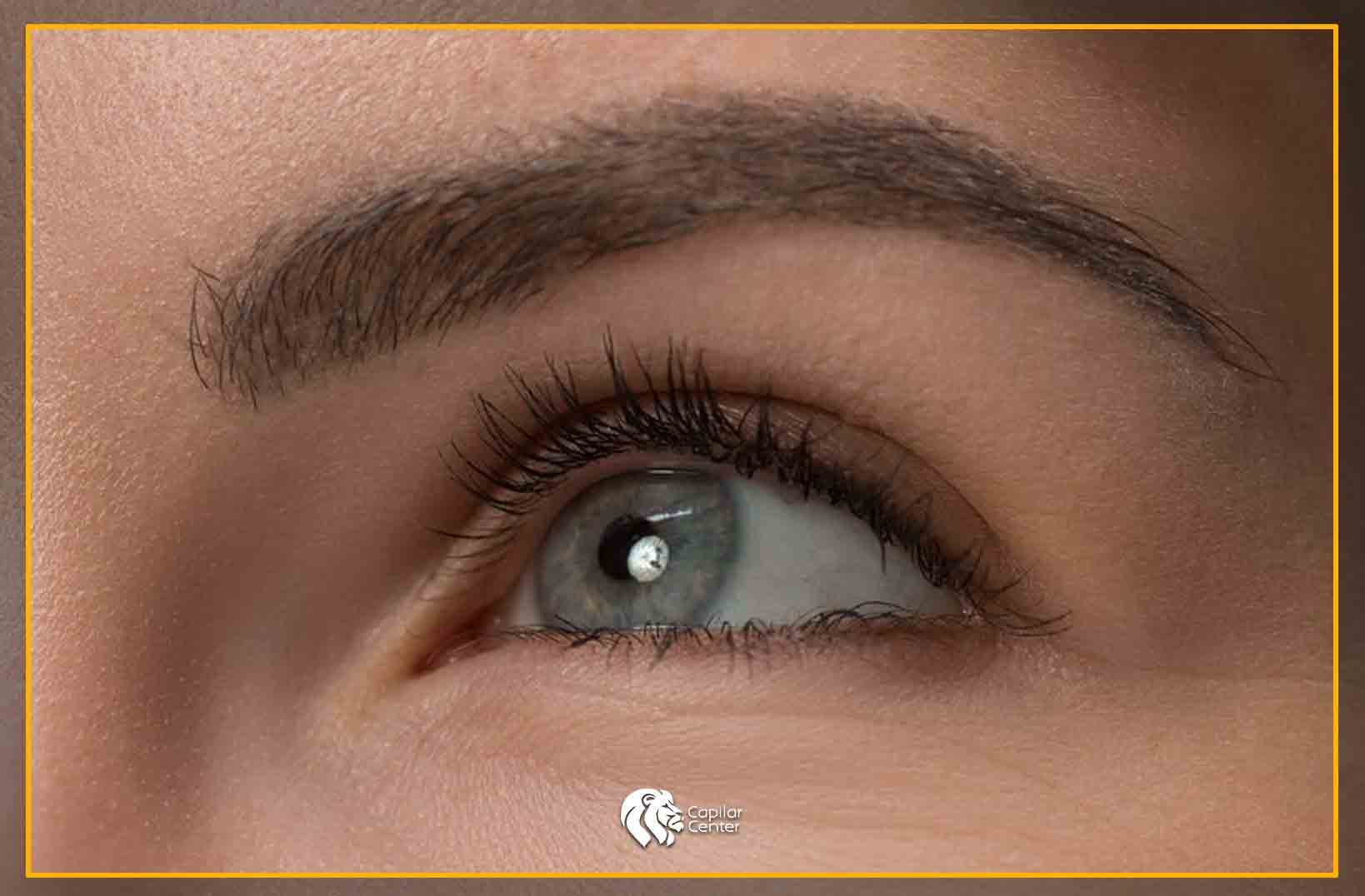 Trasplante de cejas - resultados