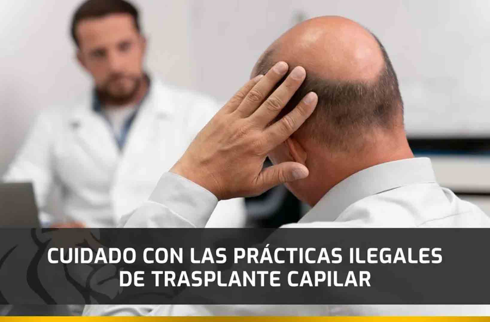 Cuidado con las prácticas ilegales de Trasplante capilar
