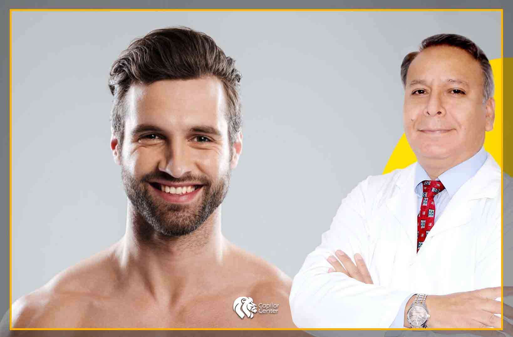 trasplante de barba - Consulta médica