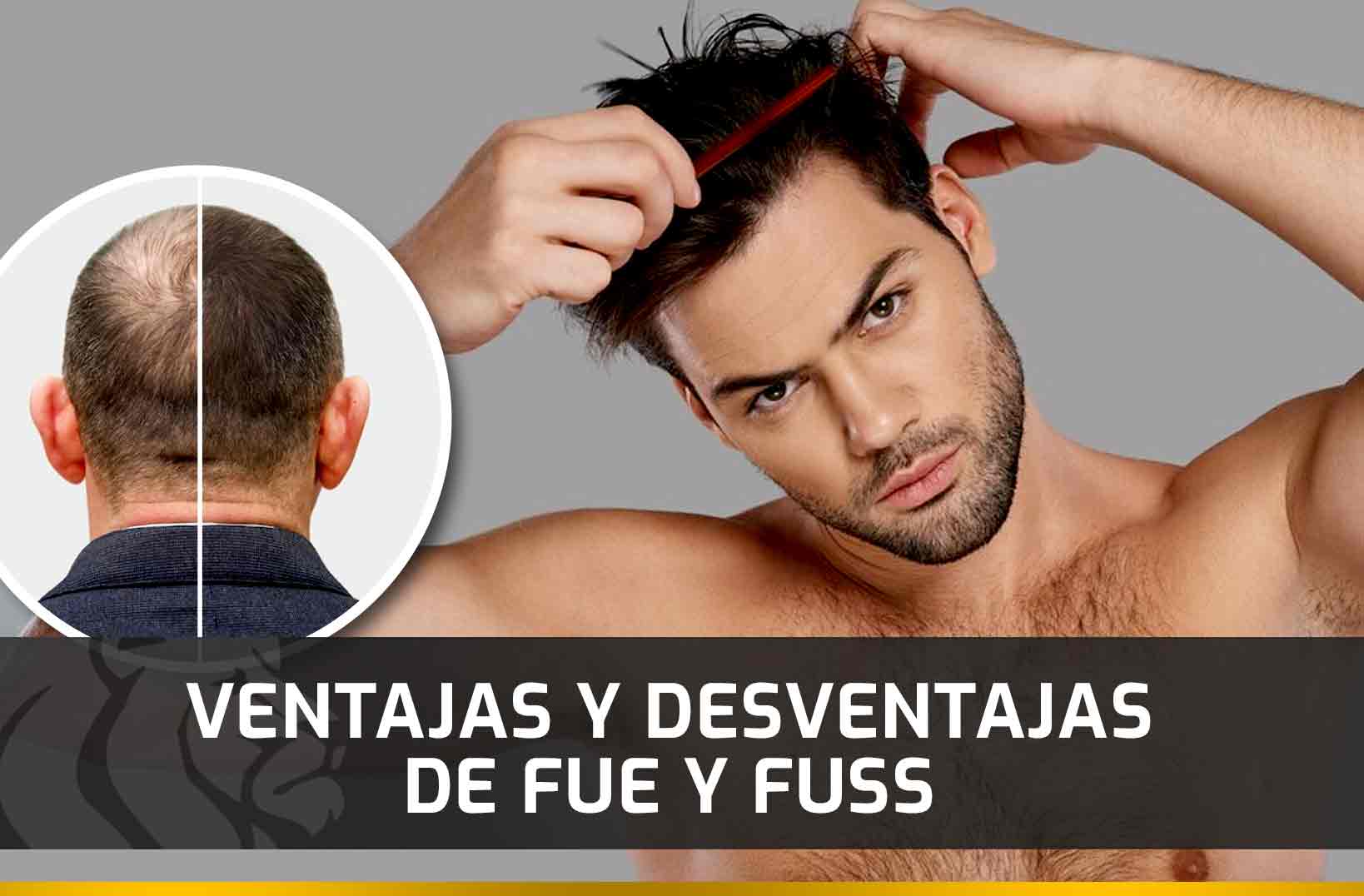 Ventajas y Desventajas de FUE y FUSS