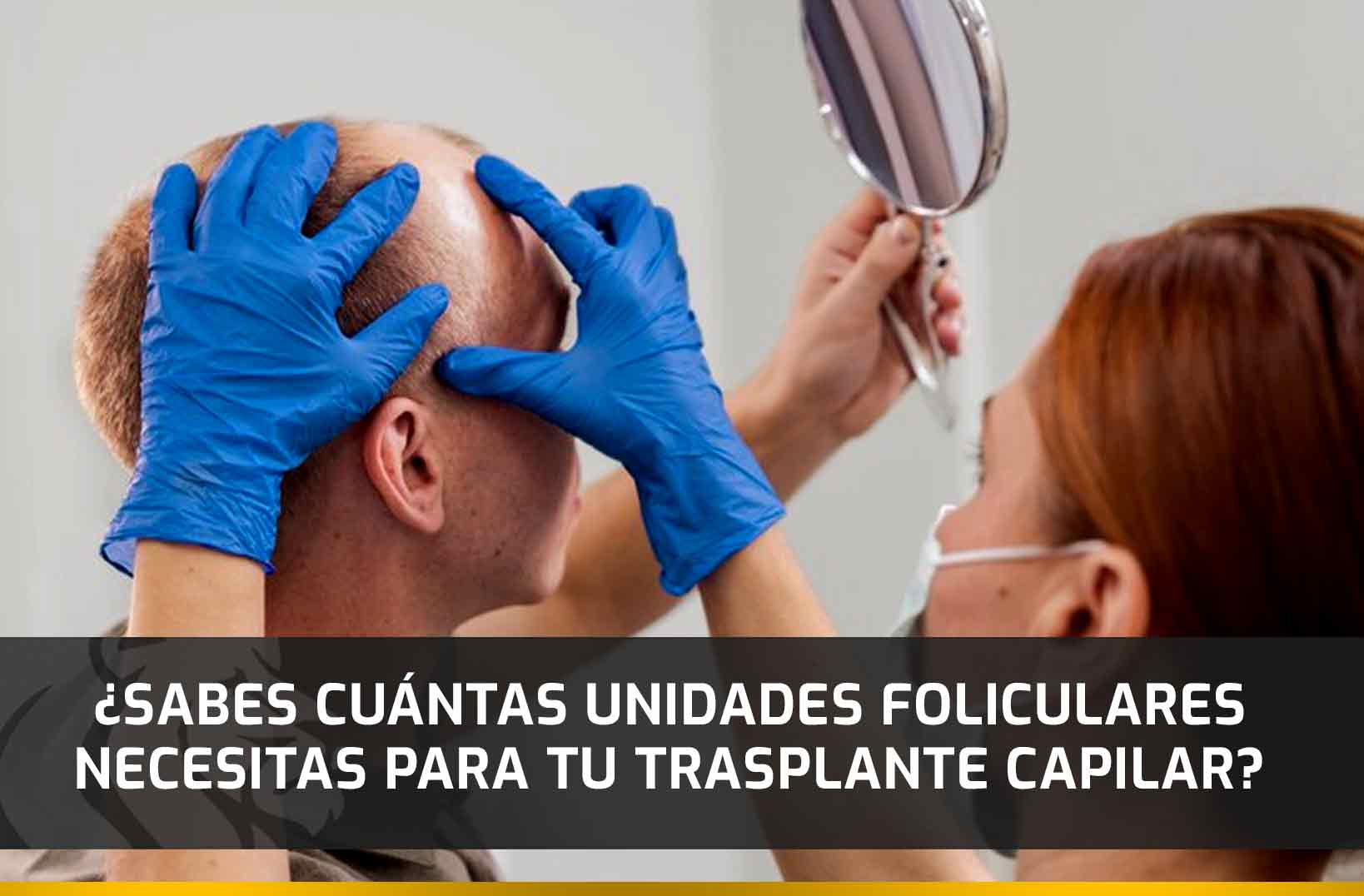 ¿Cuántas unidades foliculares necesitas para tu trasplante capilar?