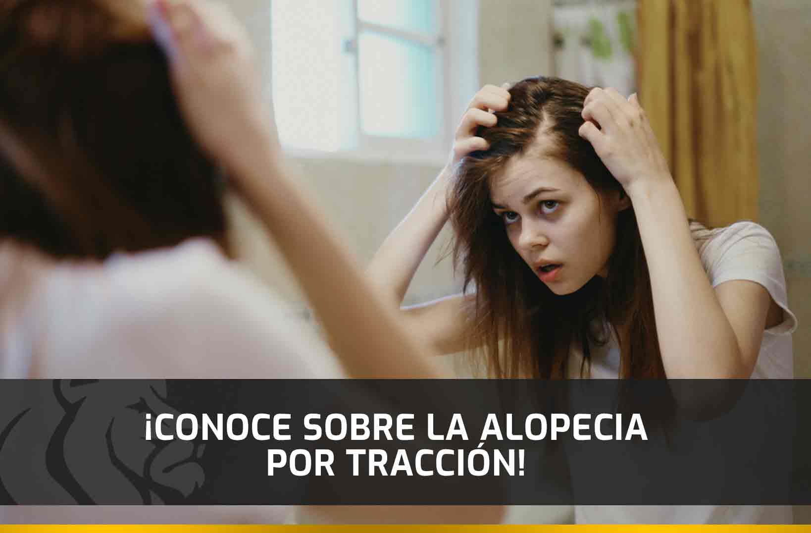 ¡Conoce sobre la Alopecia por Tracción!