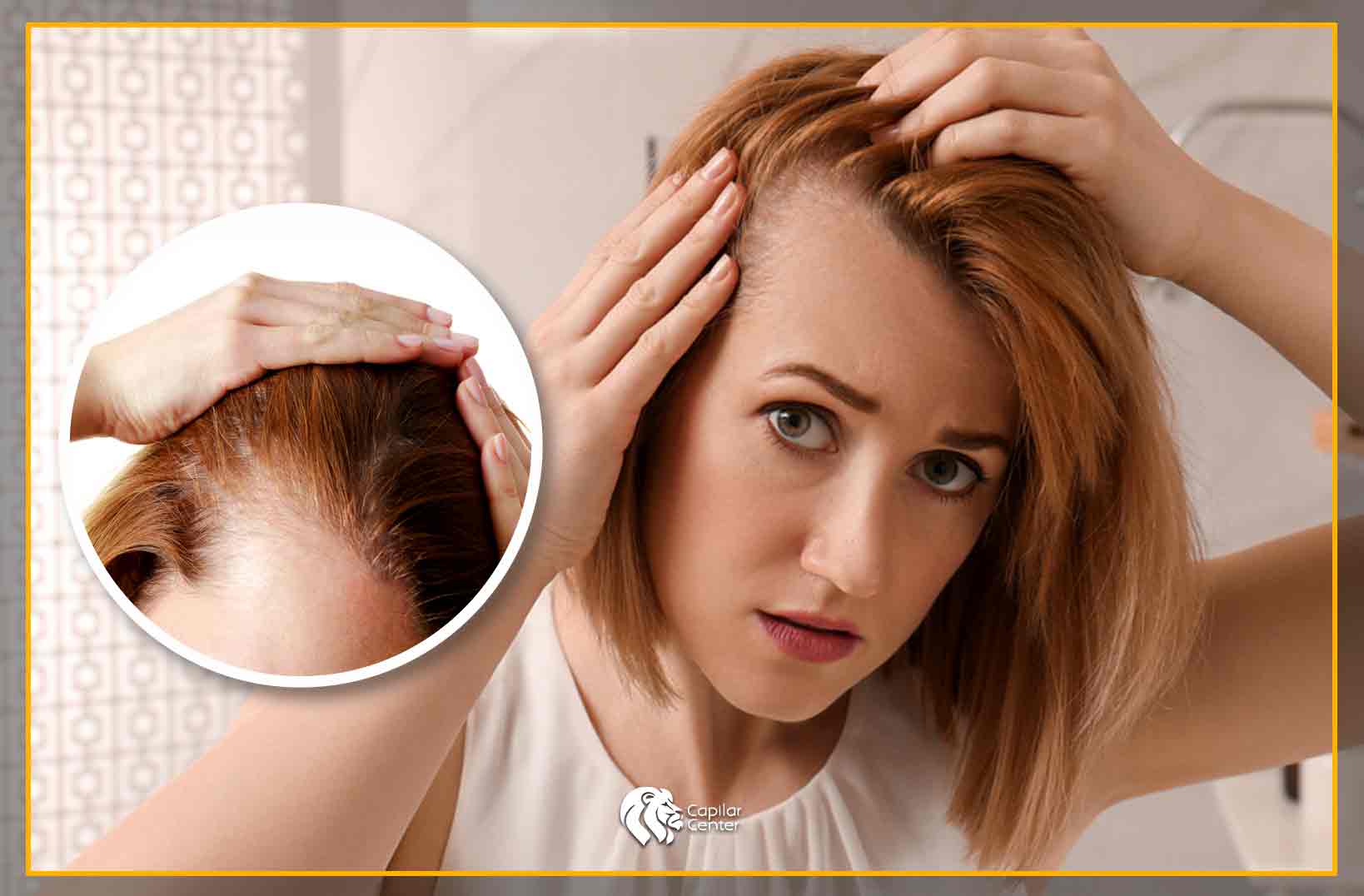 Alopecia por Tracción - Trasplante capilar