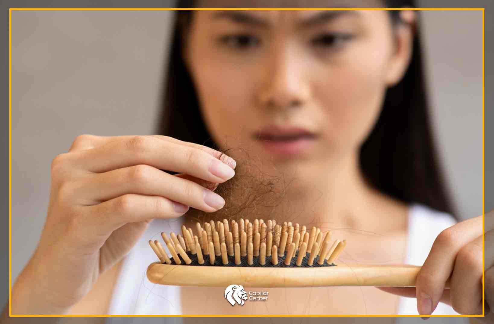Alopecia por Tracción