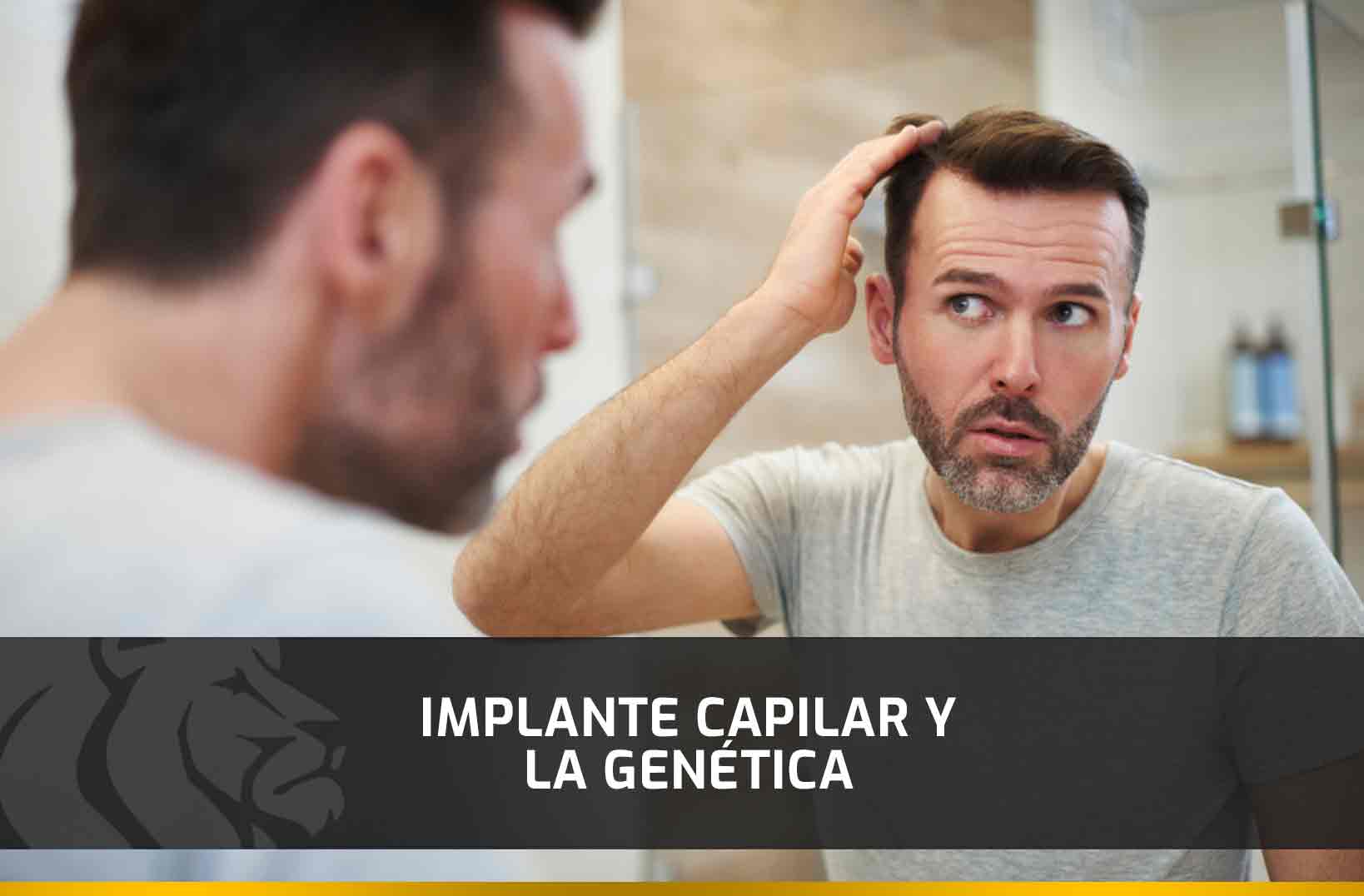 Implante capilar y la genética