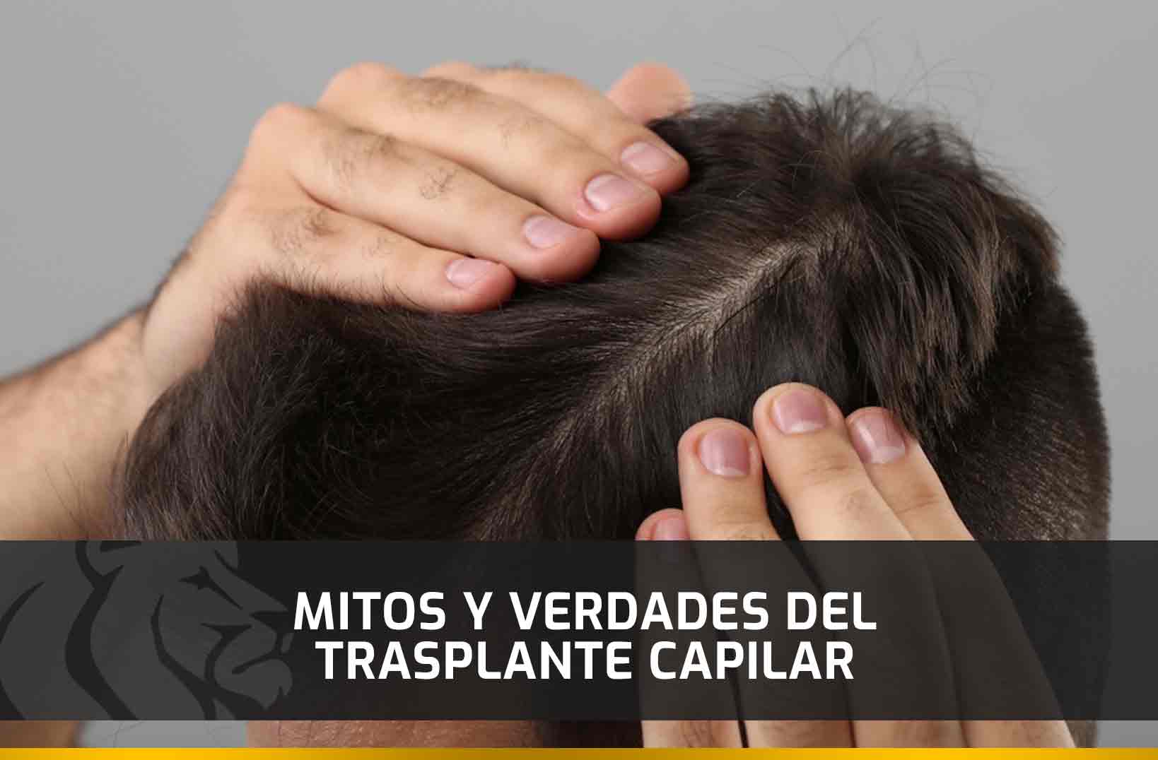 Mitos y verdades del Trasplante Capilar