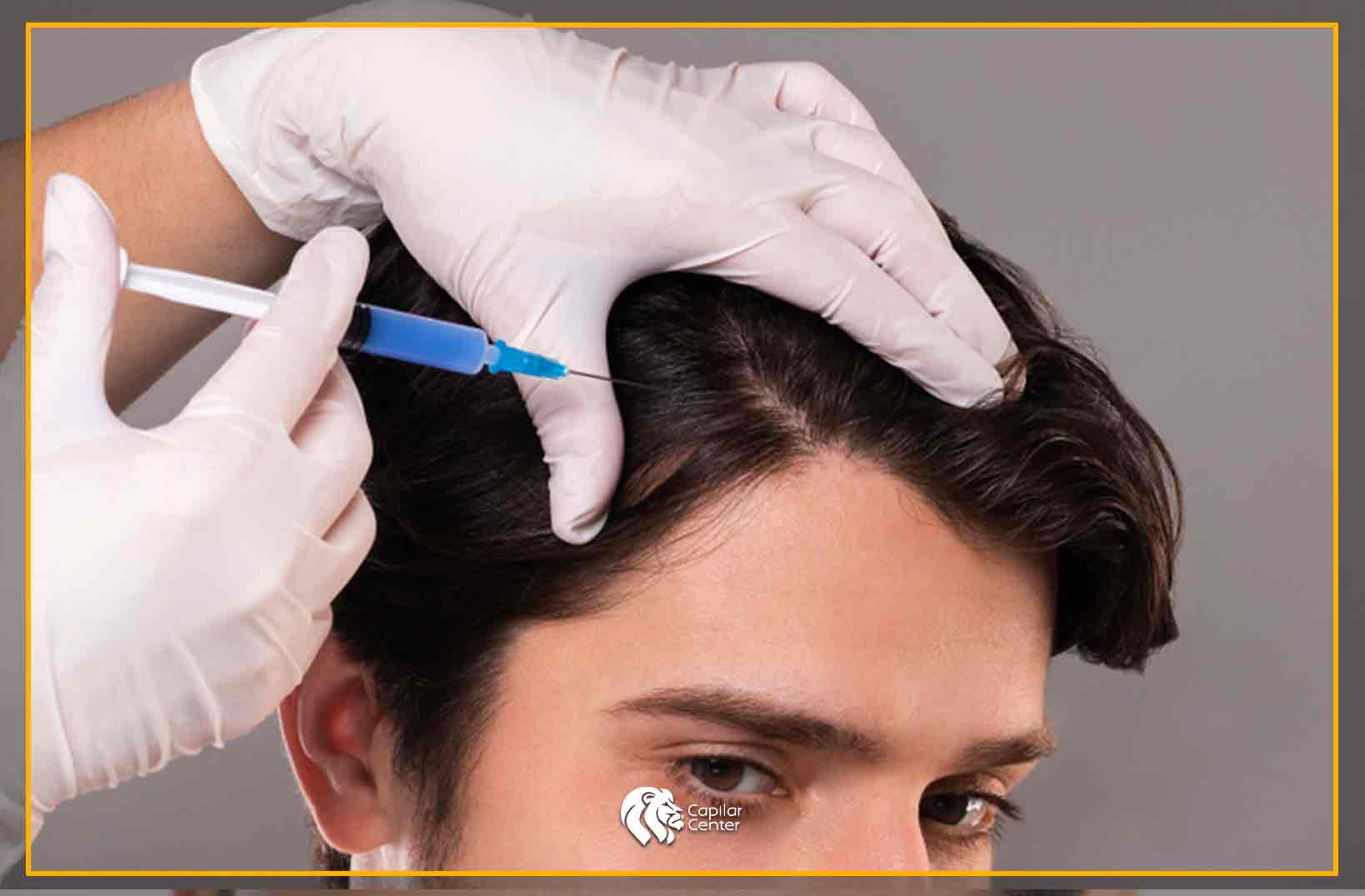 PRP: Plasma rico en plaquetas