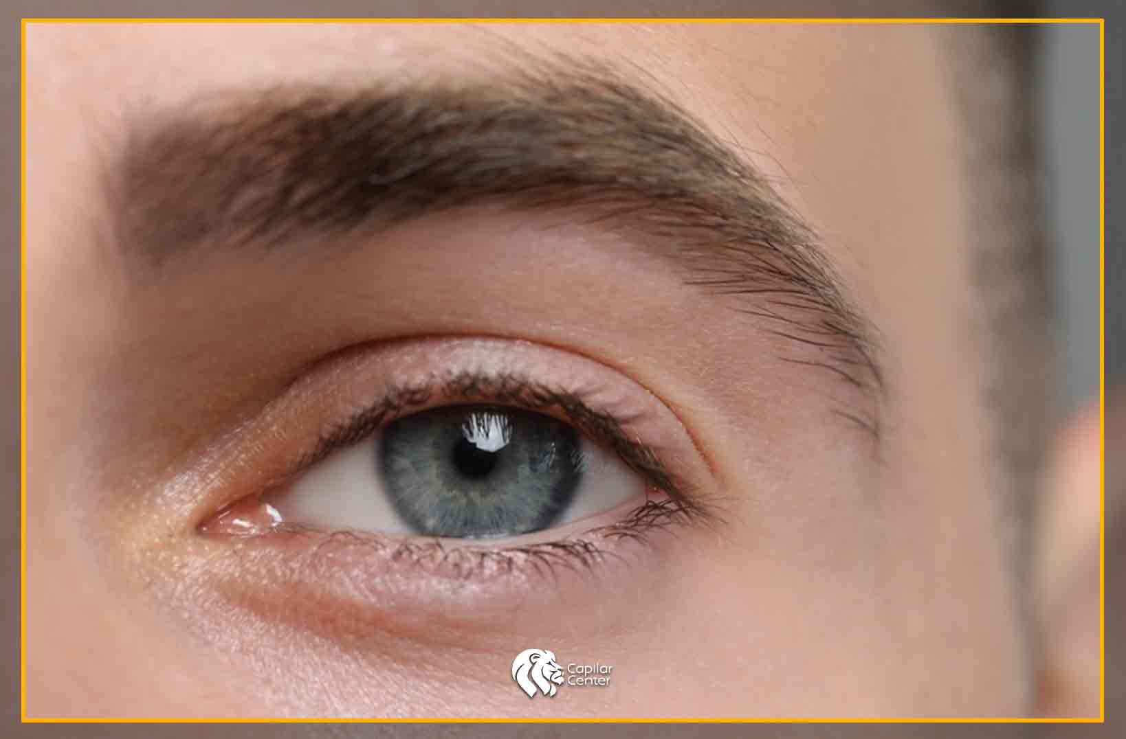 Conoce los beneficios de un Implante de Cejas en hombres