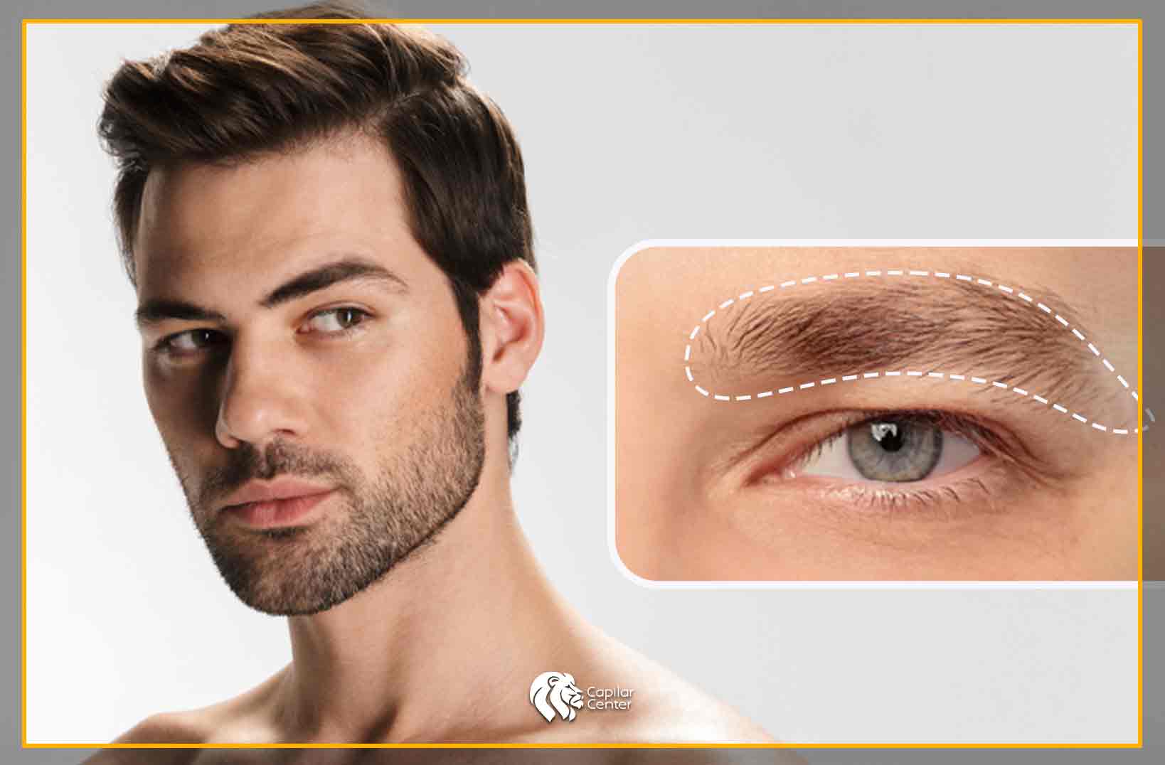 Resultados Naturales y Duraderos
