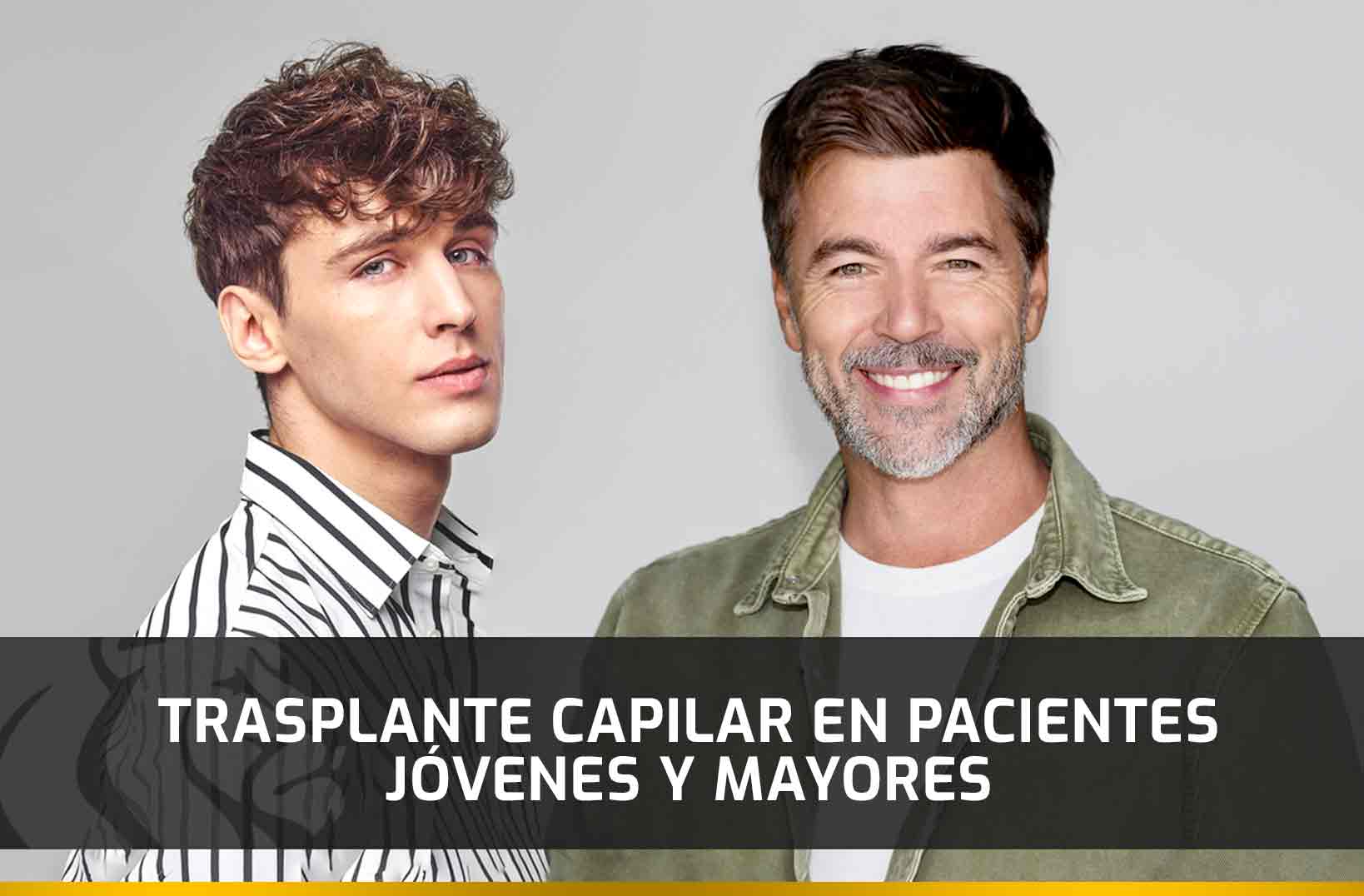 Trasplante Capilar en pacientes jóvenes y mayores