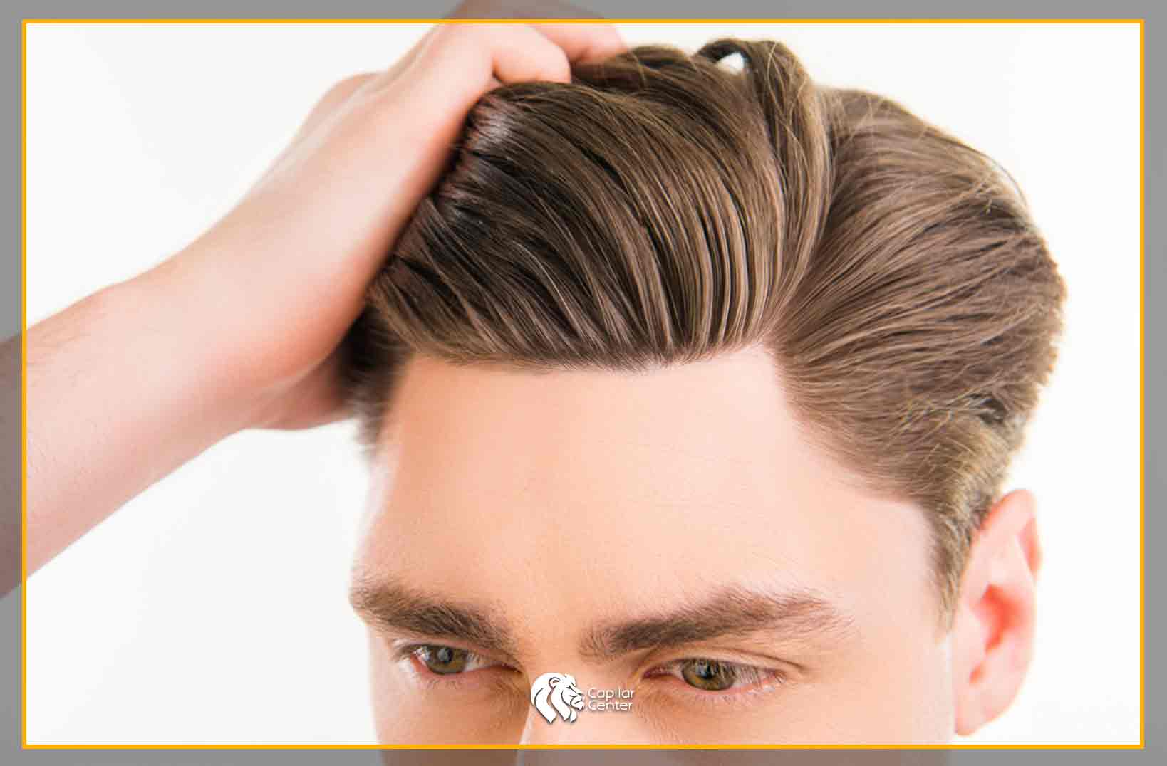 ¿Cuáles son los beneficios de esta cirugía capilar?