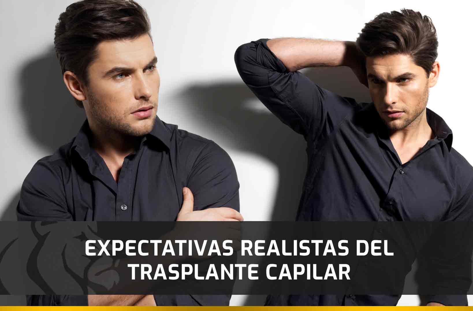 Expectativas Realistas del Trasplante Capilar