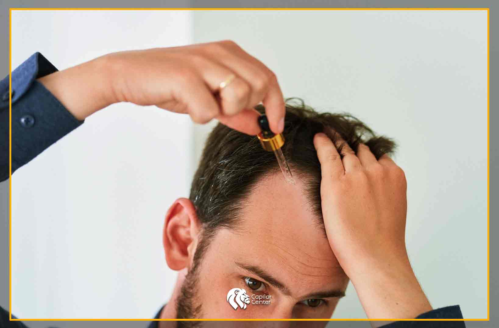 Minoxidil