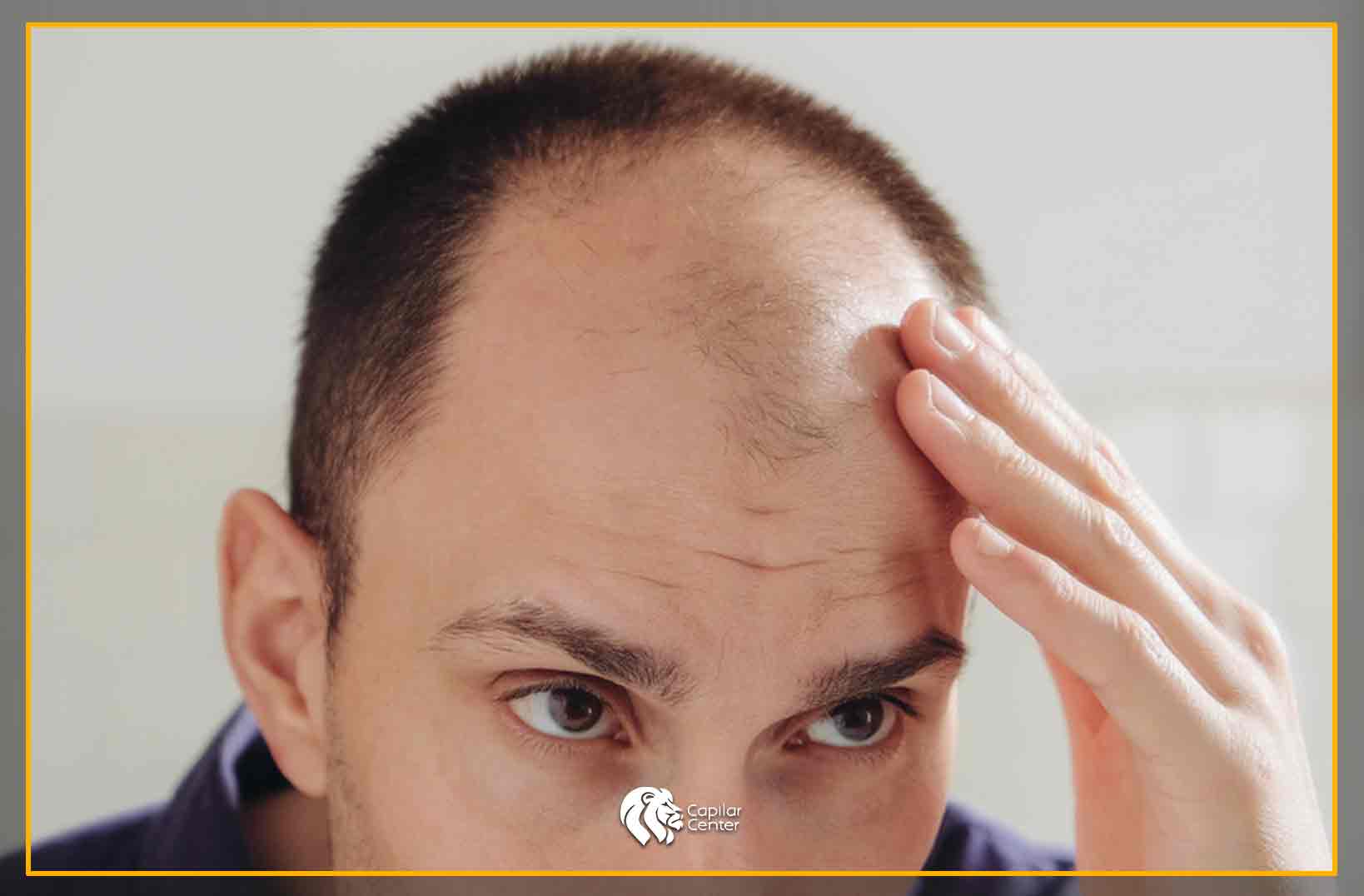 ¿Cuáles son las opciones para recuperar mi cabello?