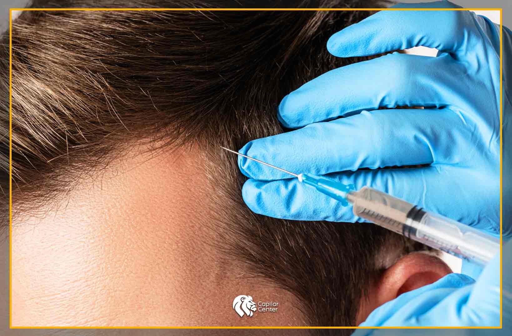 PRP (Plasma Rico en Plaquetas)