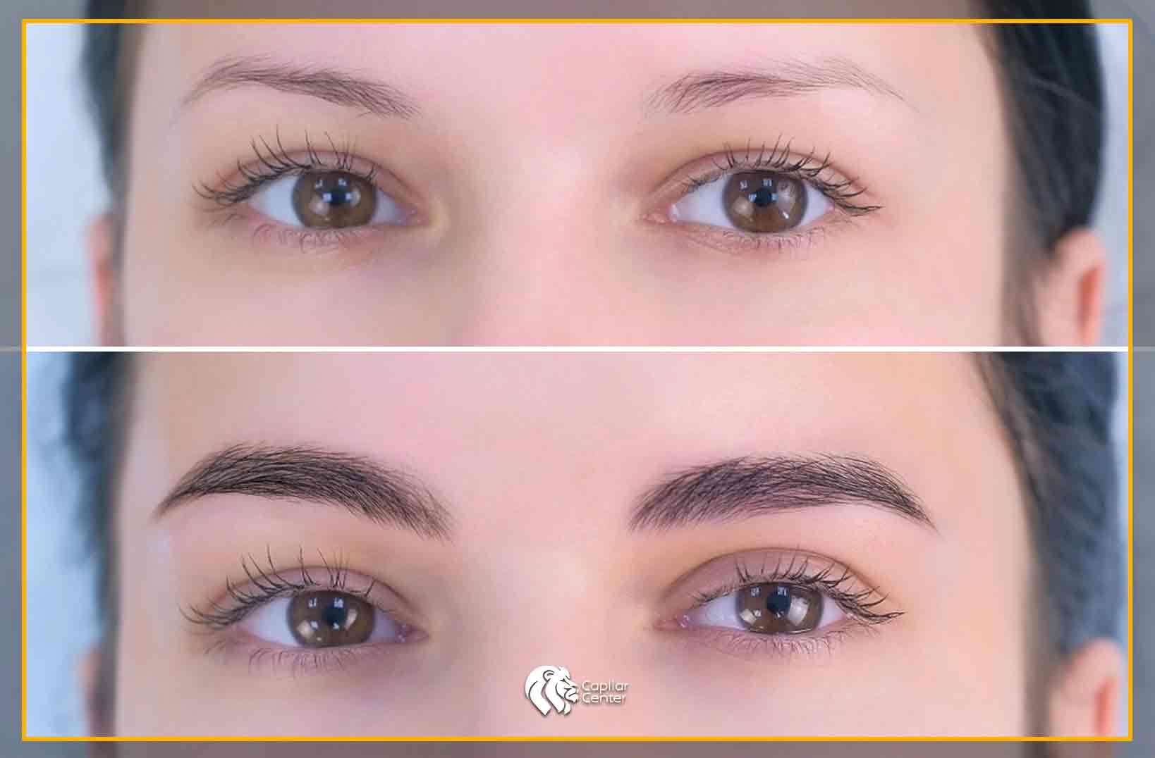 Resultados Naturales y Permanentes