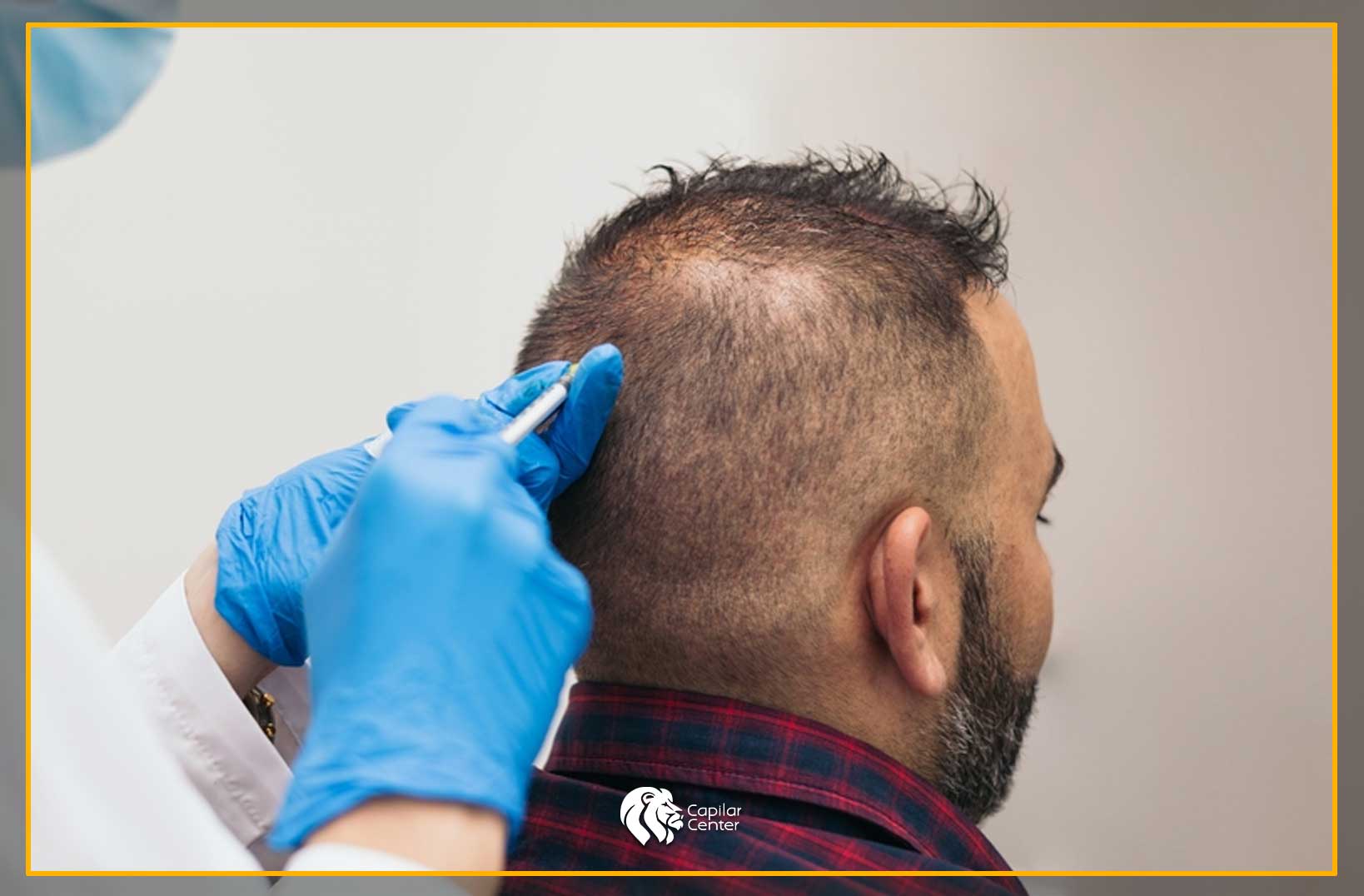 Plasma Rico en Plaquetas (PRP)