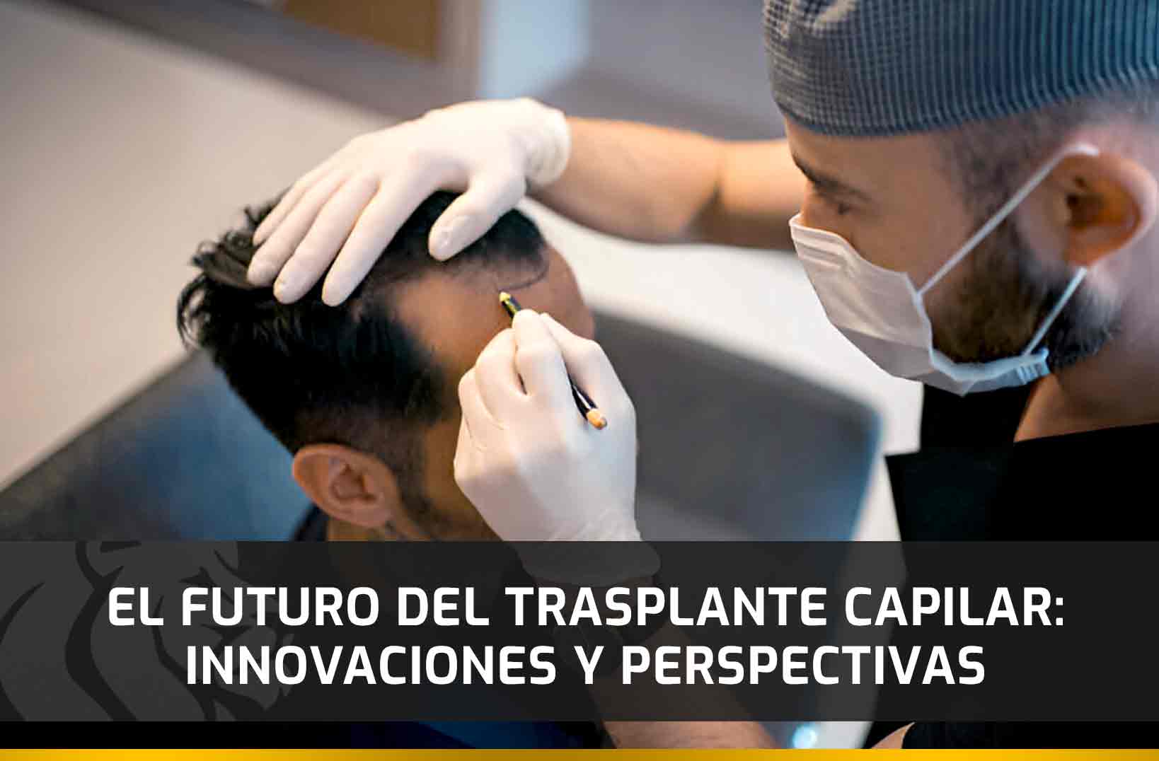 El Futuro del Trasplante Capilar: Innovaciones y Perspectivas