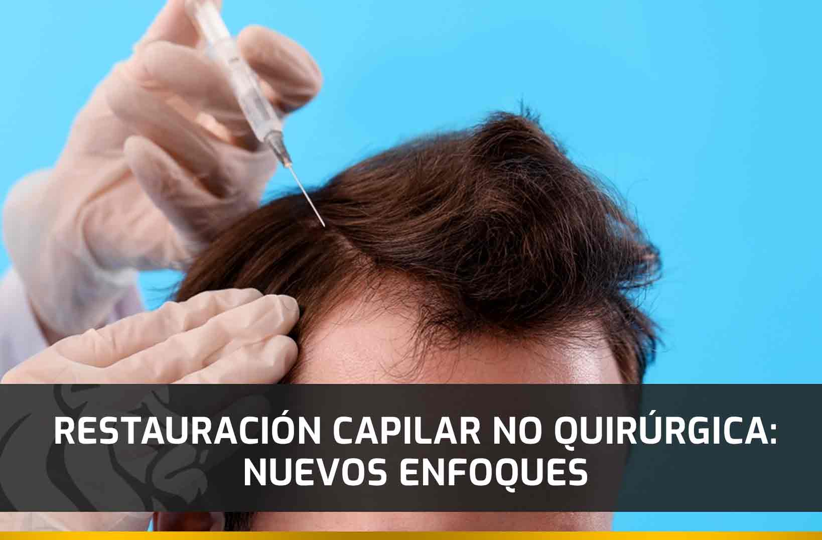 Restauración capilar no quirúrgica: Nuevos enfoques