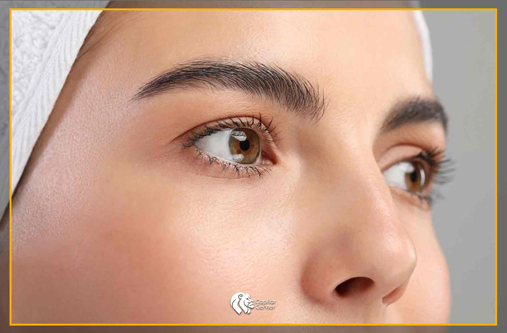 ¿Qué es el Trasplante de Cejas?