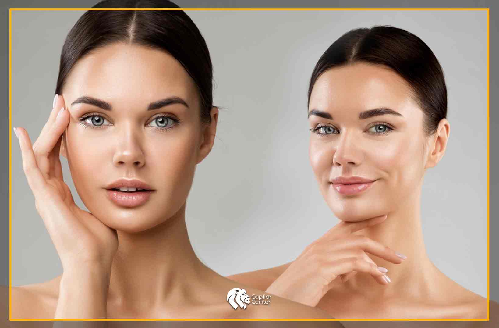 Beneficios del Trasplante de Cejas
