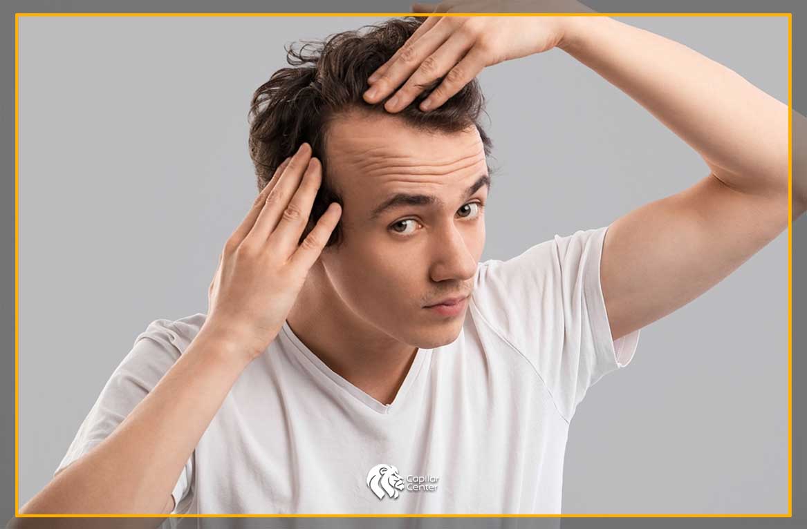 La Pérdida de Cabello: Un Problema Común