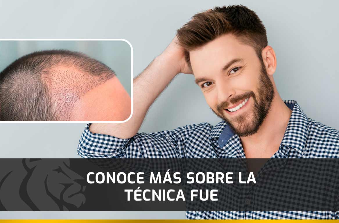 Conoce más sobre la técnica FUE