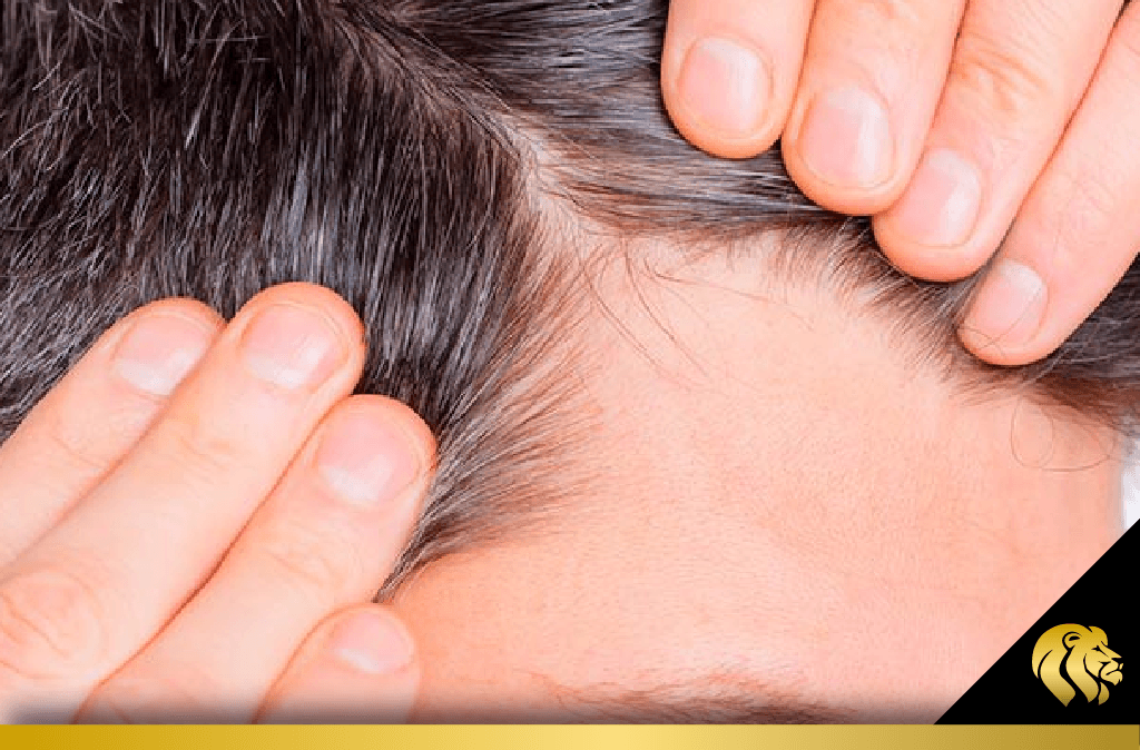 ¡Todo sobre la Guía para el cuidado del cabello tras un trasplante capilar!