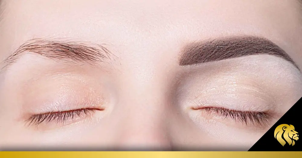 Beneficios estéticos del implante de cejas 