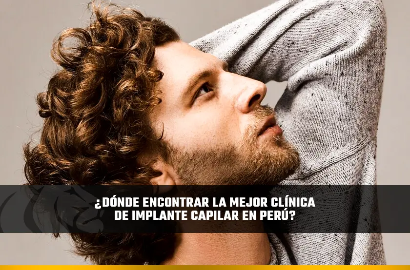 ¿Dónde Encontrar la Mejor Clínica de Implante Capilar en Perú?