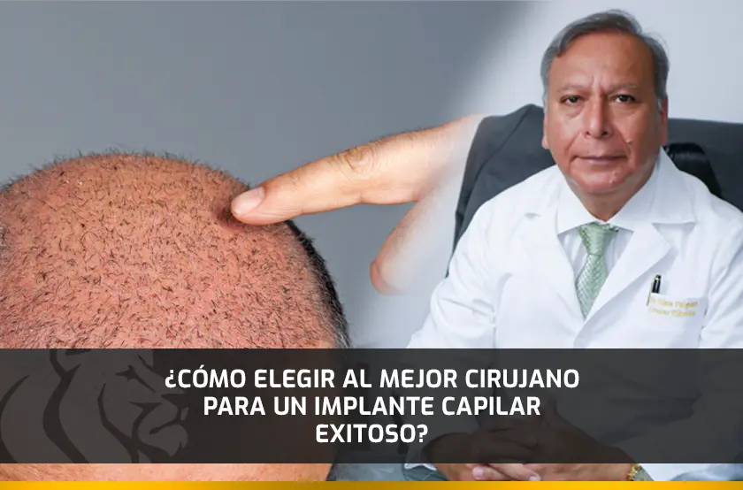 ¿Cómo Elegir al Mejor Cirujano para un Implante Capilar Exitoso?