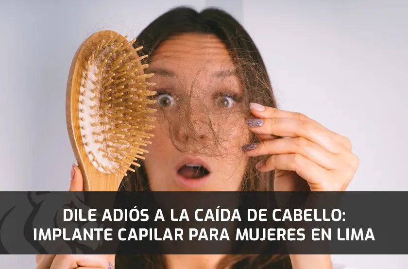 Dile Adiós a la Caída de Cabello: Implante Capilar para Mujeres en Lima