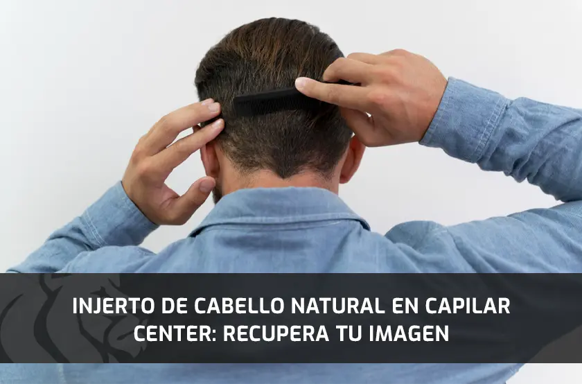 Injerto de Cabello Natural en Capilar Center: Recupera tu imagen