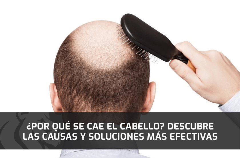 ¿Por qué se cae el Cabello? Descubre las Causas y Soluciones Más Efectivas